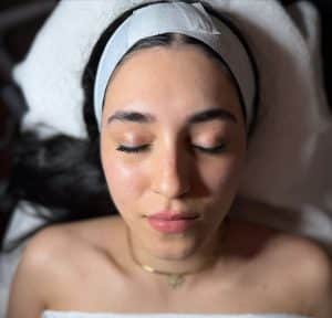 Treat acne scars professionally in Vancouver