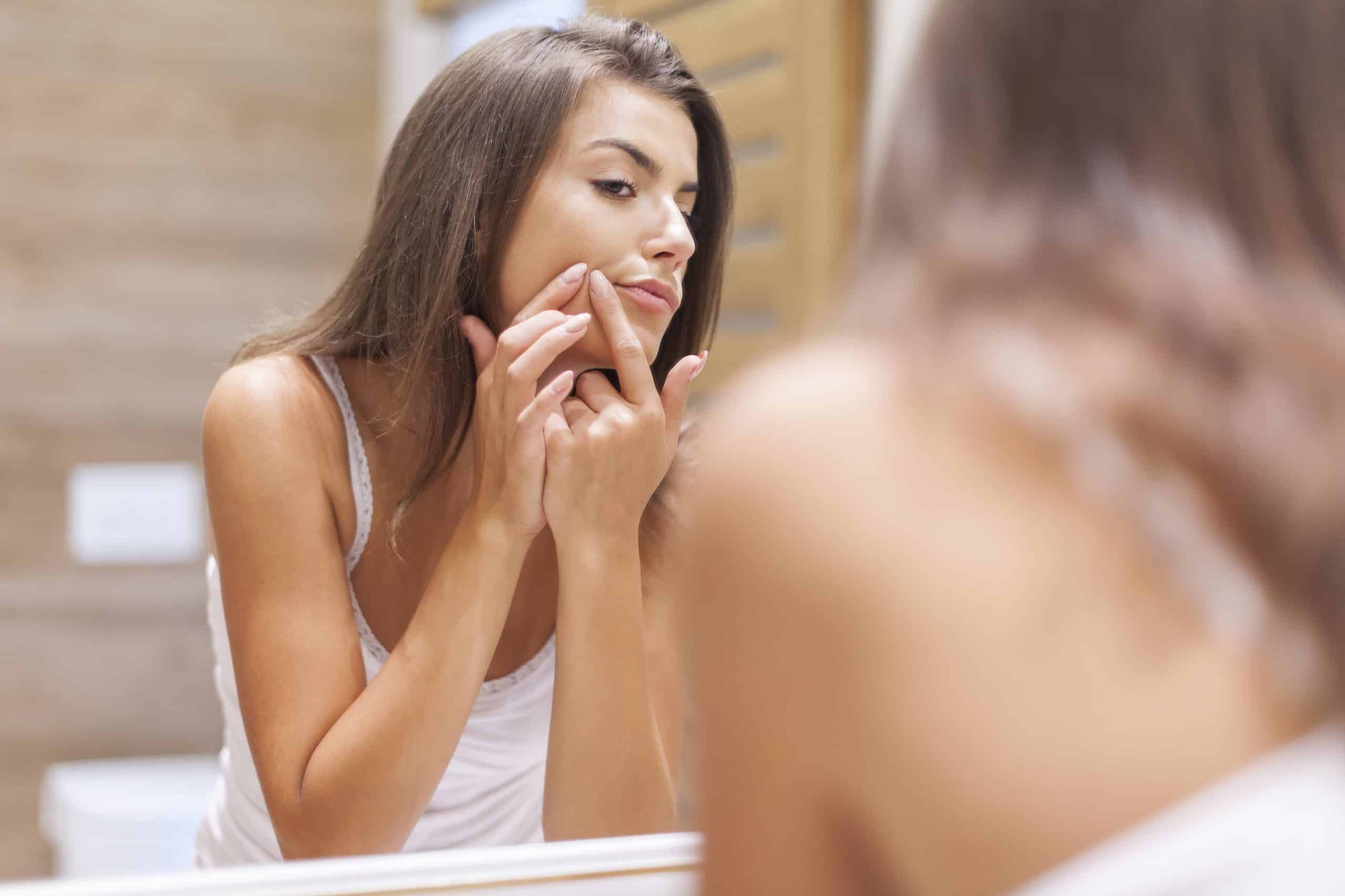 Best Treatments for Acne Scars