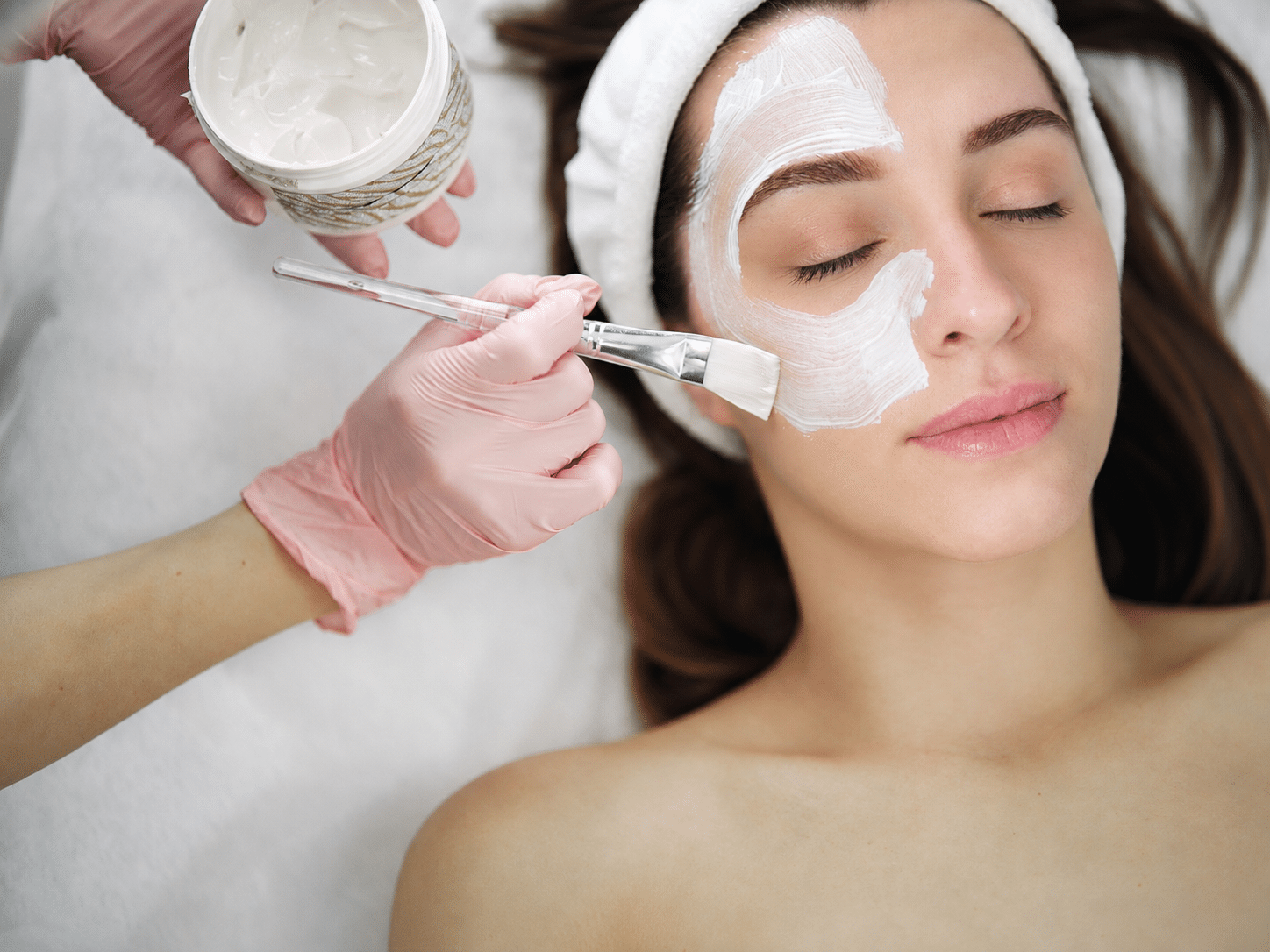 What a Chemical Peel in Vancouver Actually Does And What It Costs
